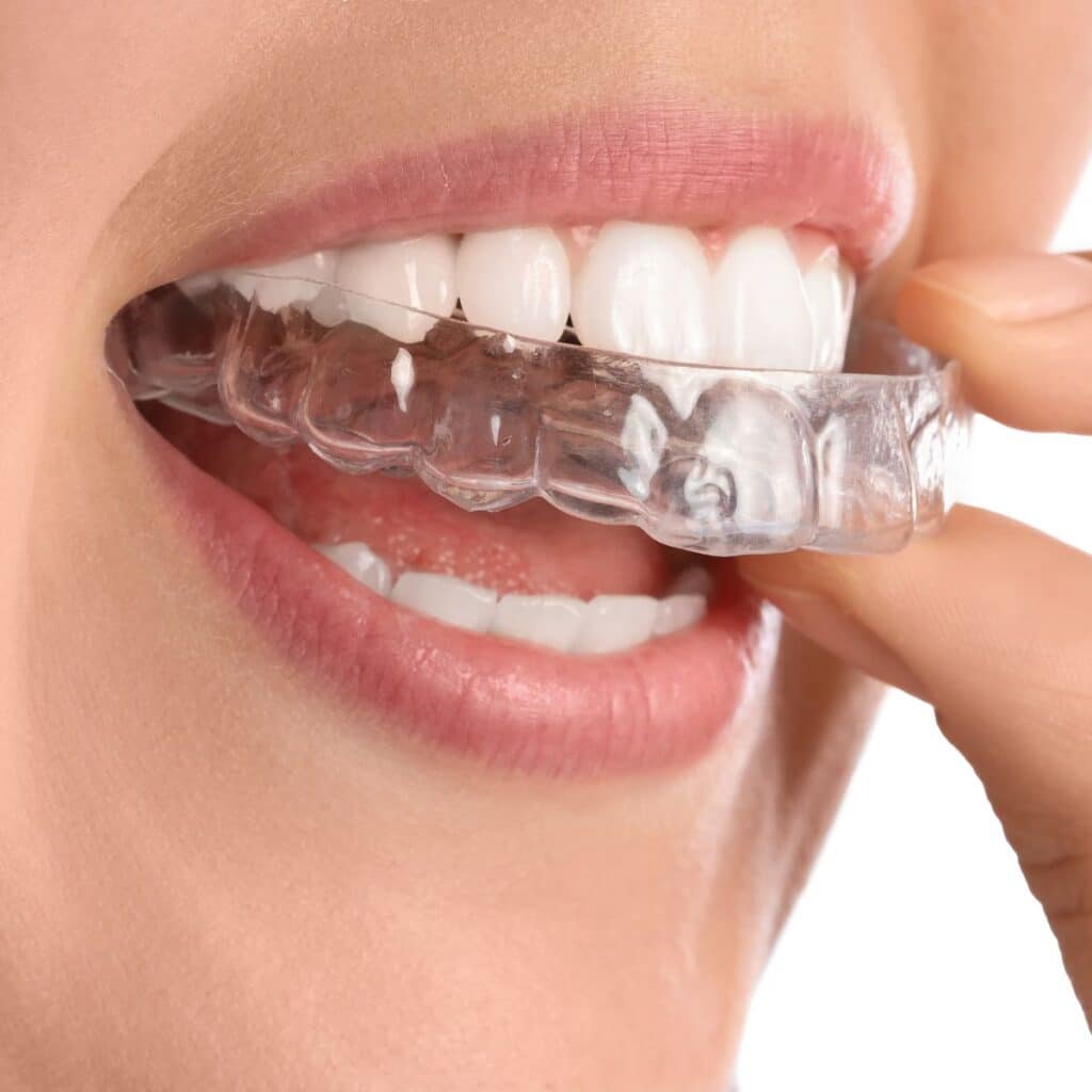 Zahn-Funktionstherapie